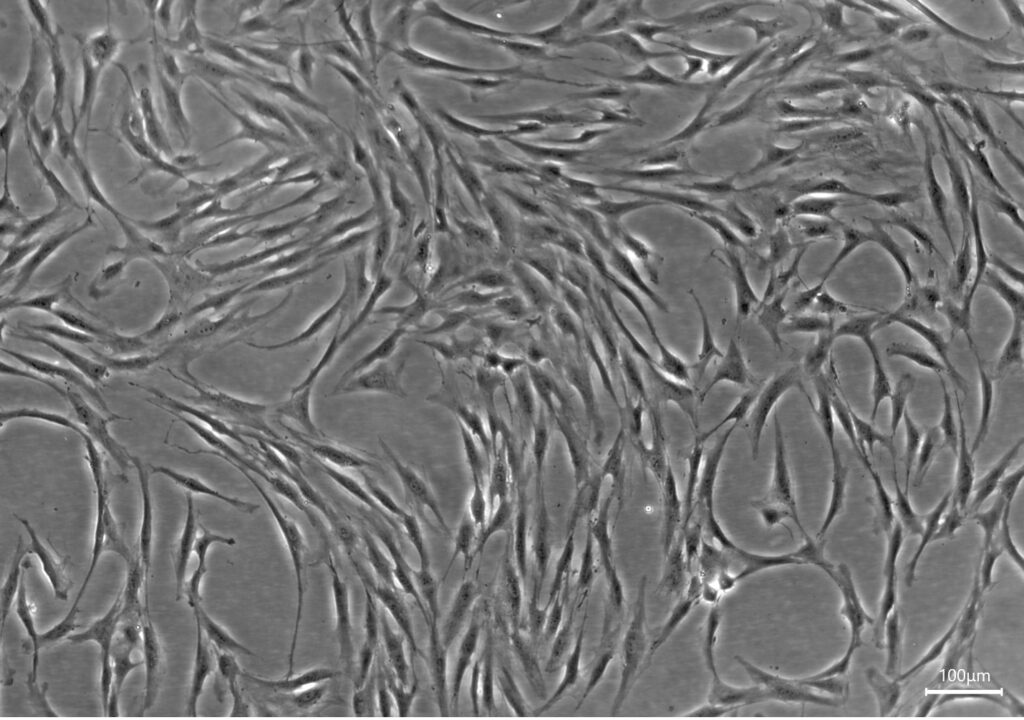 Human Bone Marrow Derived Mesenchymal Stem Cells